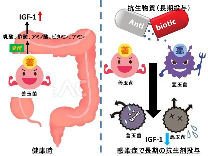 円形脱毛症　病院